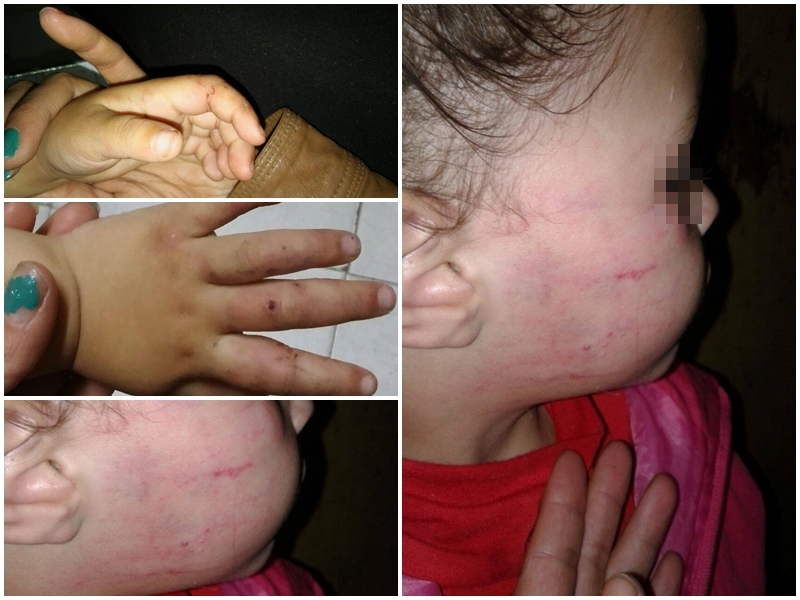 El pasado sábado, en el barrio El Carmen de Berisso, una nena de tres años fue salvajemente golpeada por su padrastro, Matías Rolando Álvez de 20 años, quien, para ocultar los moretones, la maquilló; la madre ya radicó la denuncia, pero la justicia solo ordenó la perimetral.