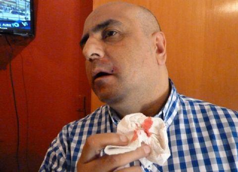 Salvaje agresión de Francisco de Narváez al director de Agencia NOVA