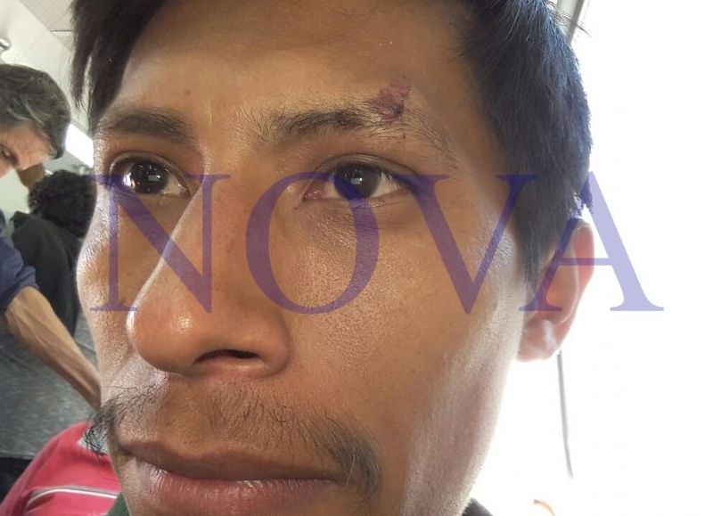 Isaac Quispe Rojas, periodista de NOVA, recibió un balazo de goma en su ceja izquierda. (Foto: NOVA)
