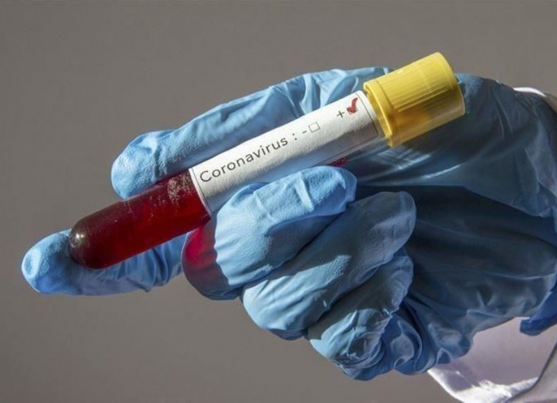 Hay ocho casos confirmados de coronavirus.