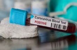 Se registraron 2 nuevos casos de coronavirus en Berisso y son 65 en total