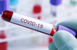 Reportan 22 nuevos contagios de Covid en nuestra ciudad