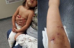 El relato de una madre tras el ataque de un pitbull a su beba de un año: "Pensé que la mataba"