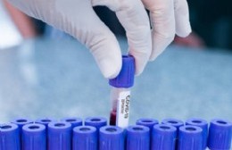 Dos nuevos casos confirmados de coronavirus en Berisso y son 67 en total
