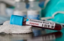 Se registraron 40 nuevos casos de coronavirus en Berisso