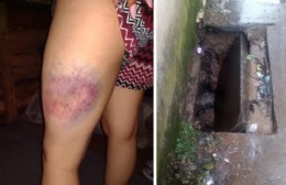 Su hija se cayó en un pozo y se lesionó: “Al día de hoy la Municipalidad no lo tapó”