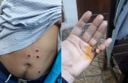 Tras incidentes frente a su sede, el SUPeH exhortó al "cese de la violencia institucional"