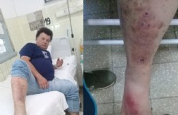 Un hijo angustiado y un padre a punto de perder su pie denuncian negligencia en el Hospital Larraín